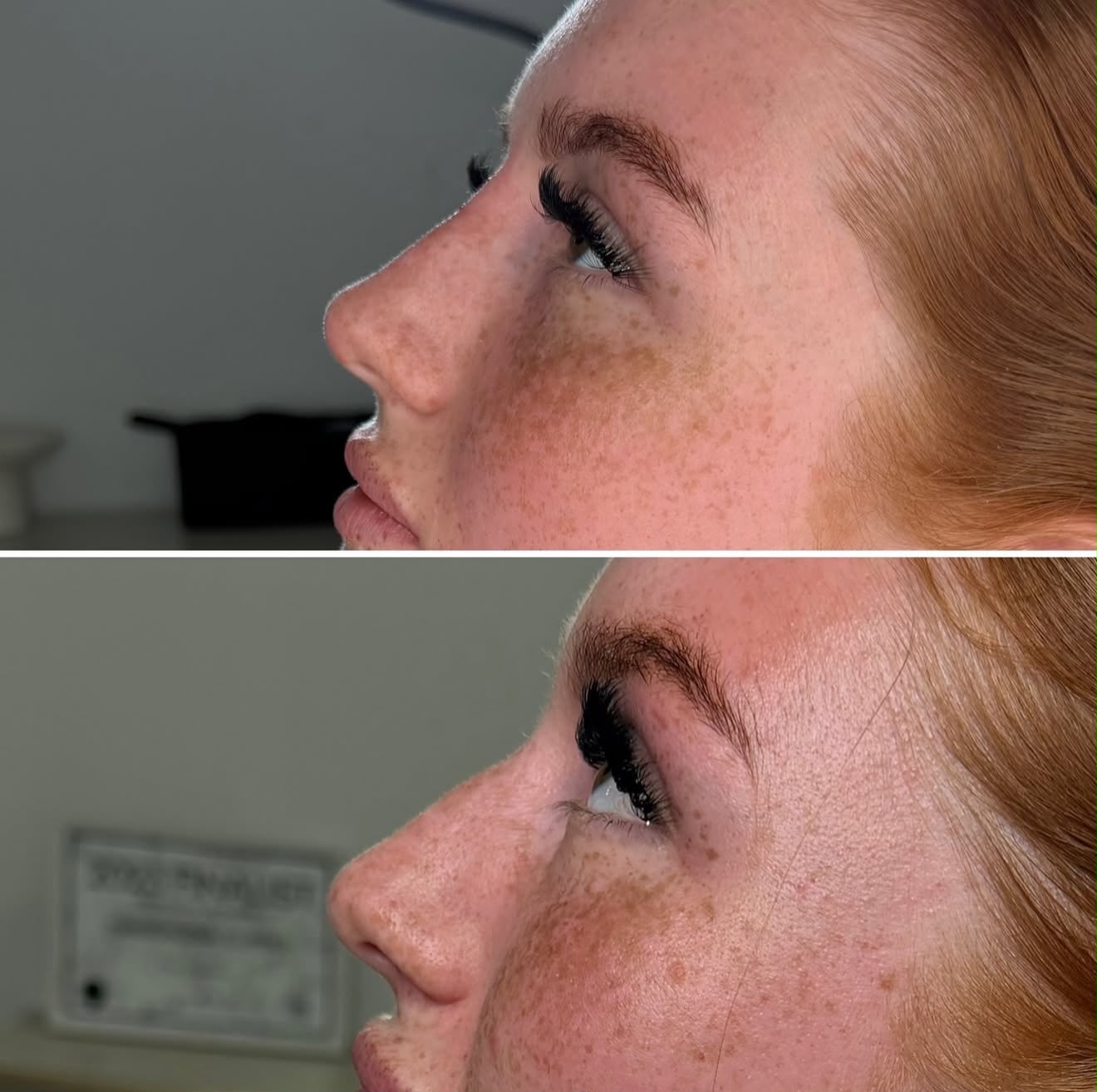 Two close-up photographs of facial skin